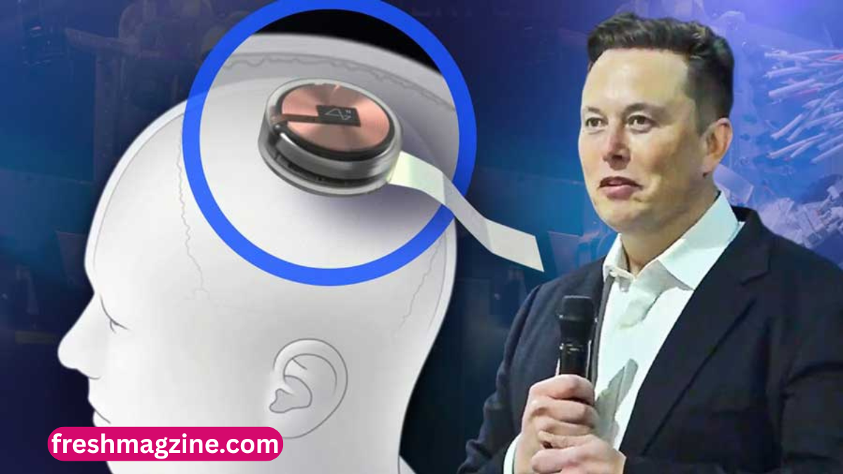 Elon musk neuralink stock